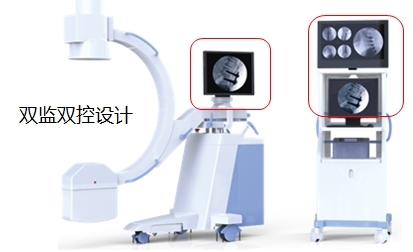雙監(jiān)雙控C臂機(jī)PLX112C 雙監(jiān)雙控C臂機(jī)PLX112C